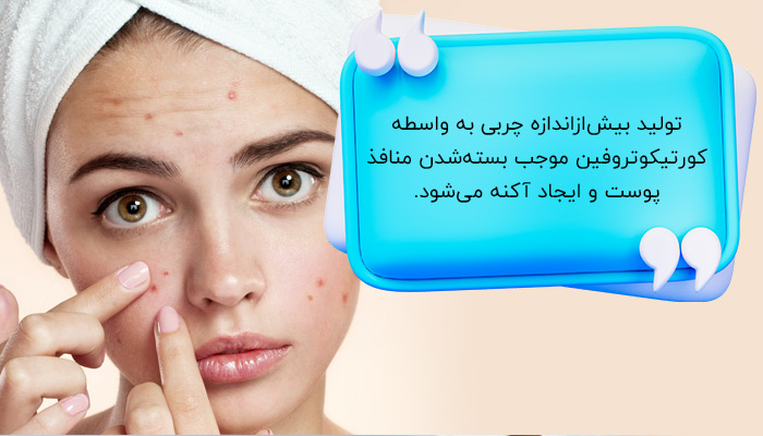 آکنه؛ تأثیر استرس بر پوست