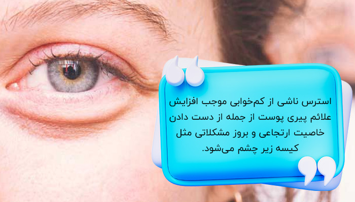 کیسه‌های زیر چشم؛ تأثیر استرس بر پوست
