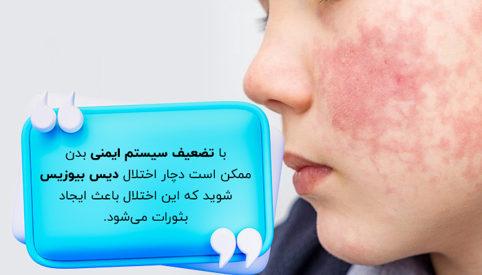 بثورات؛ تأثیر استرس بر پوست