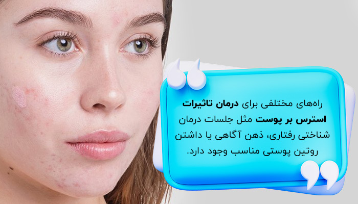 درمان تأثیر استرس بر پوست